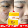 Effective Whitening Freckles Face Cream Remove Melasma Dark Spots Fade Pigmentation Acne Scars Moisturizing Brighten Beauty Care