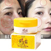 Effective Whitening Freckles Face Cream Remove Melasma Dark Spots Fade Pigmentation Acne Scars Moisturizing Brighten Beauty Care